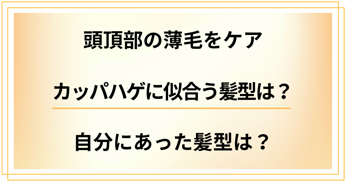 カッパハゲに似合う髪型は？頭頂部の薄毛をケアしながら自分にあった髪型にするには？