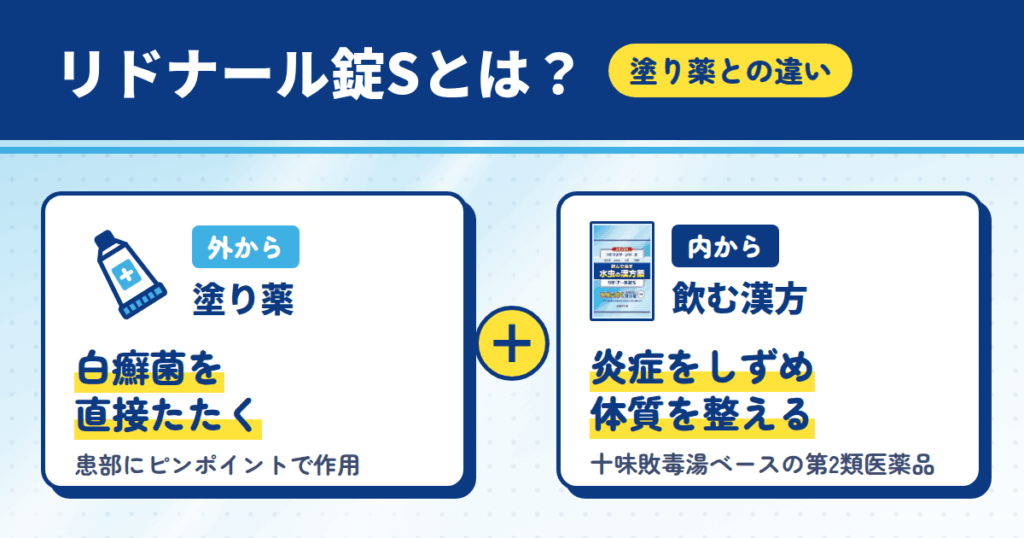 「飲むリドマスター(リドナール錠S)」とは?塗り薬との違い